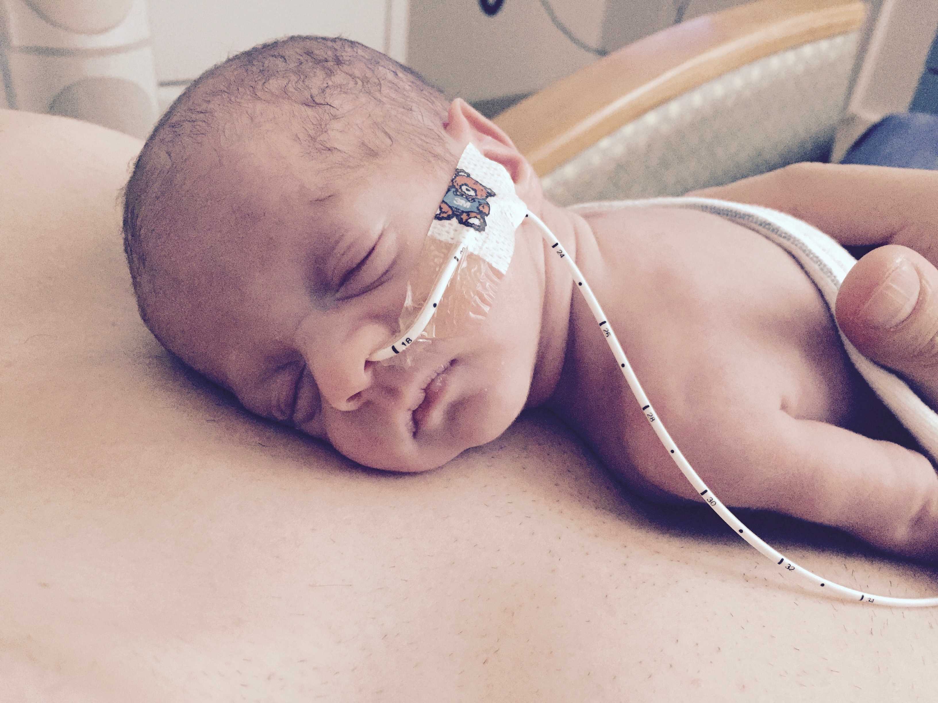 Challenges of raising a premature baby - NICU to one year