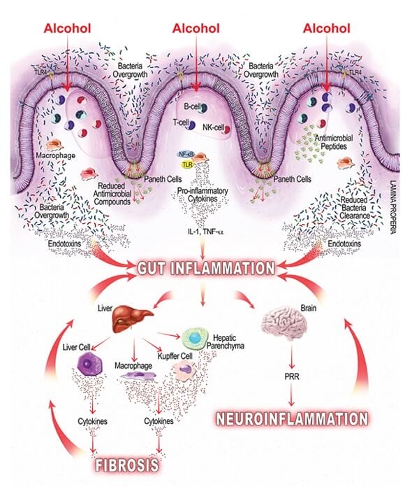 Alcohol causes inflammation in the gut.