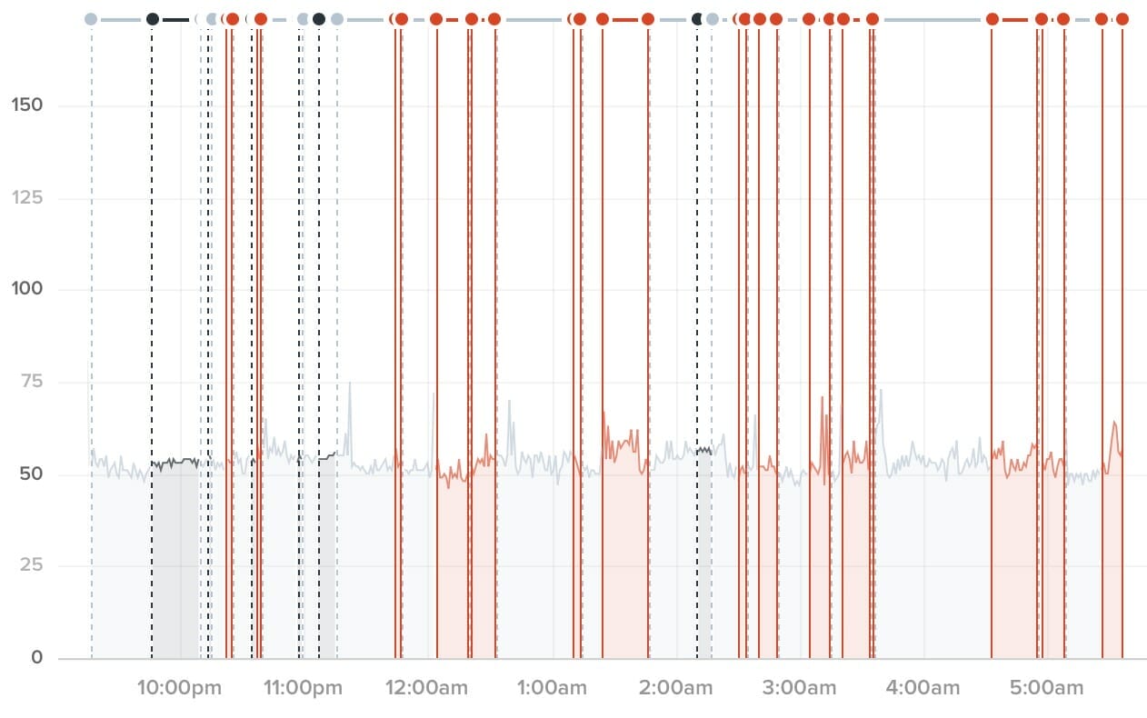 A wild night filled with dreams (REM sleep). You can see I woke up during a REM sleep cycle.
