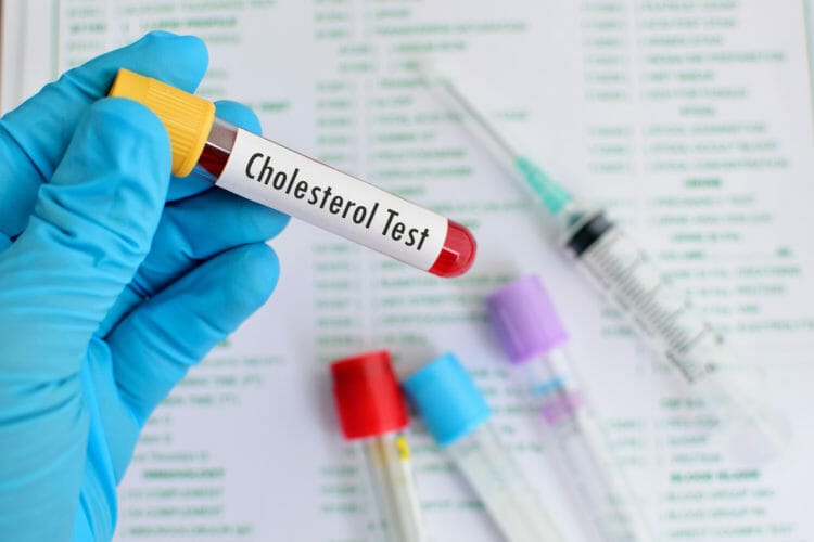 Elevated cholesterol