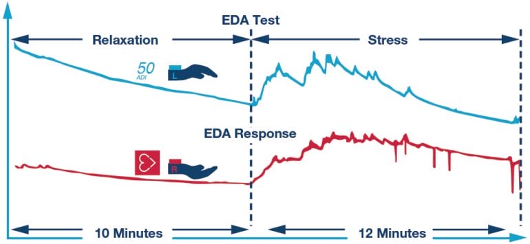 Changes in electrodermal activity and heart rate in response to music