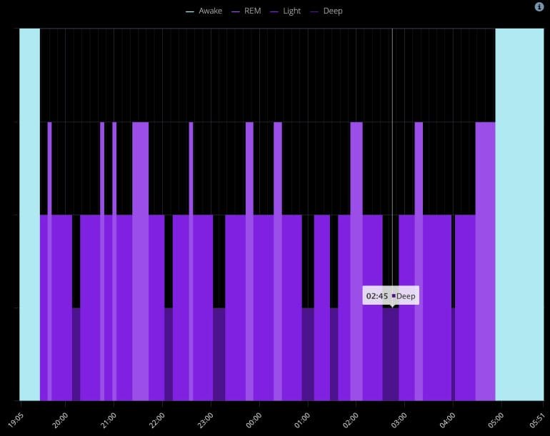 Sleep stage analysis by Emfit QS