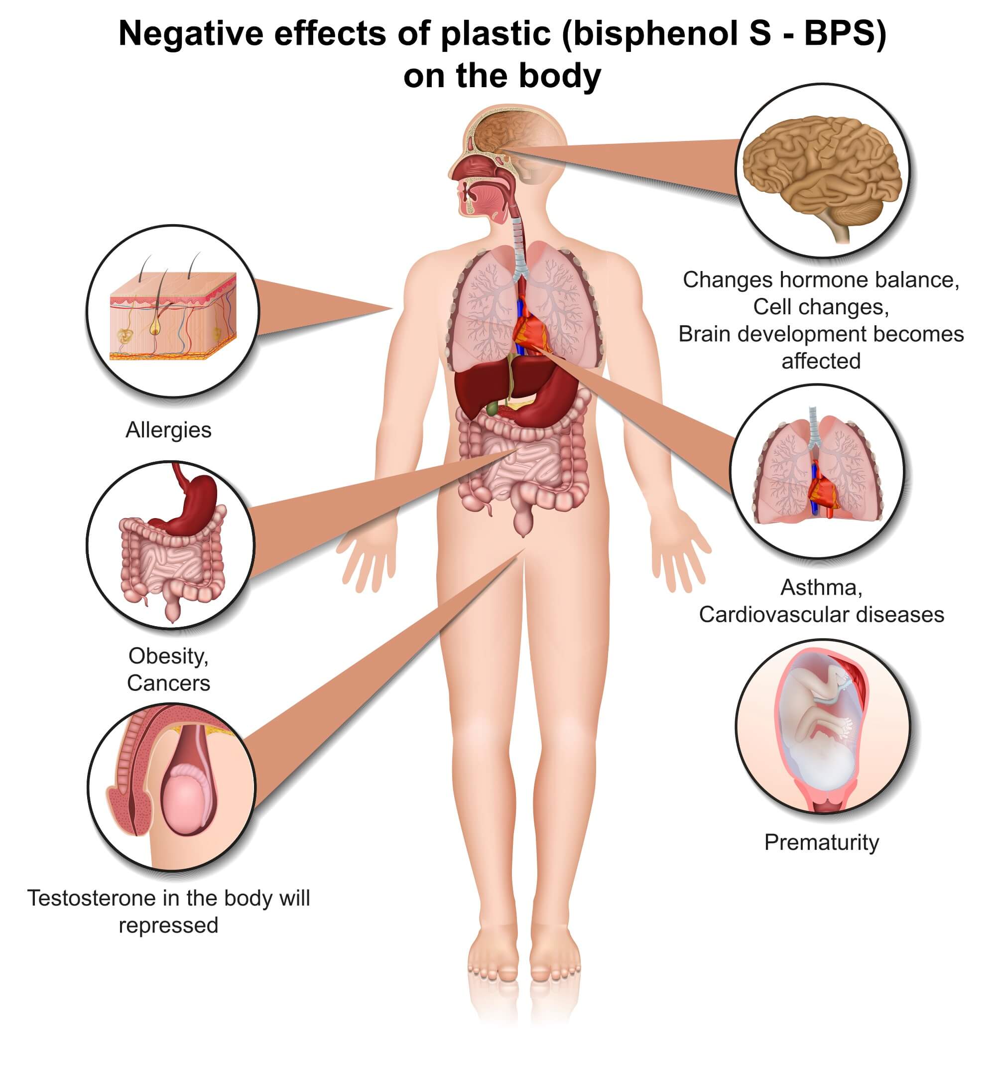 Infographic explaining why BPS is just as bad as BPA