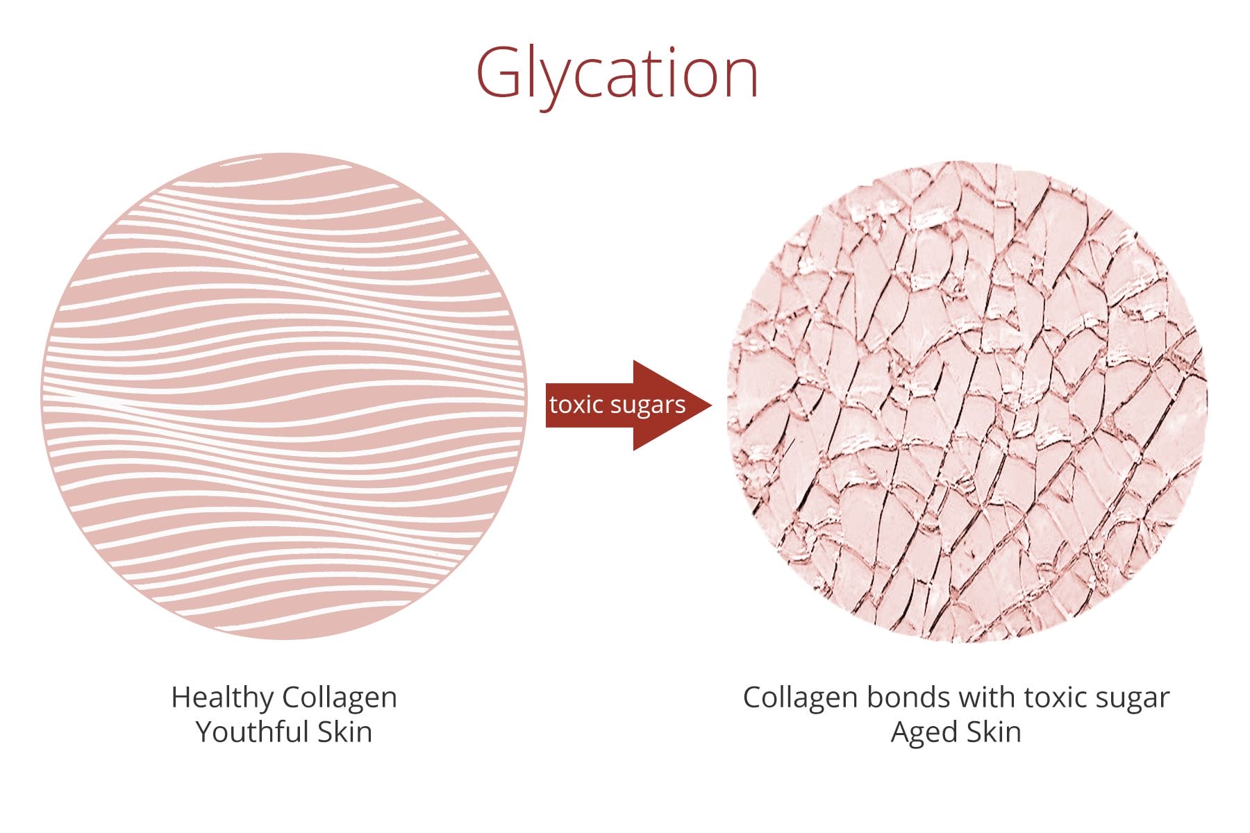 Glycation damages cells and speeds up aging.