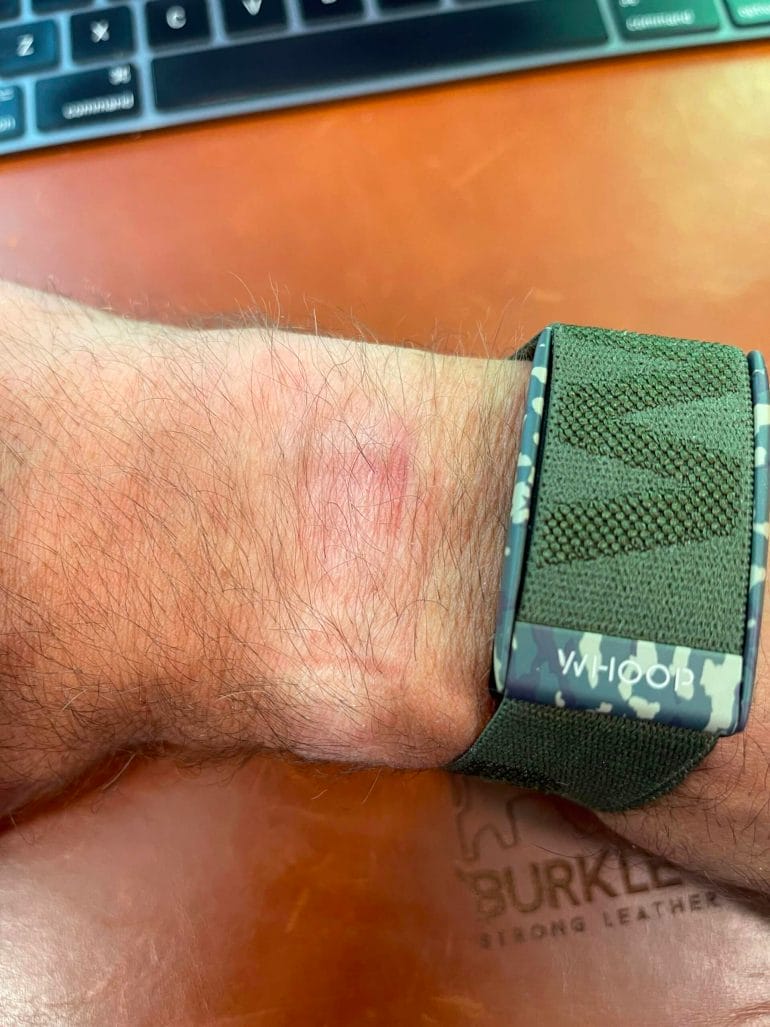 I love my Baseknit strap because it ensures that the sensor stays in close contact with my skin.