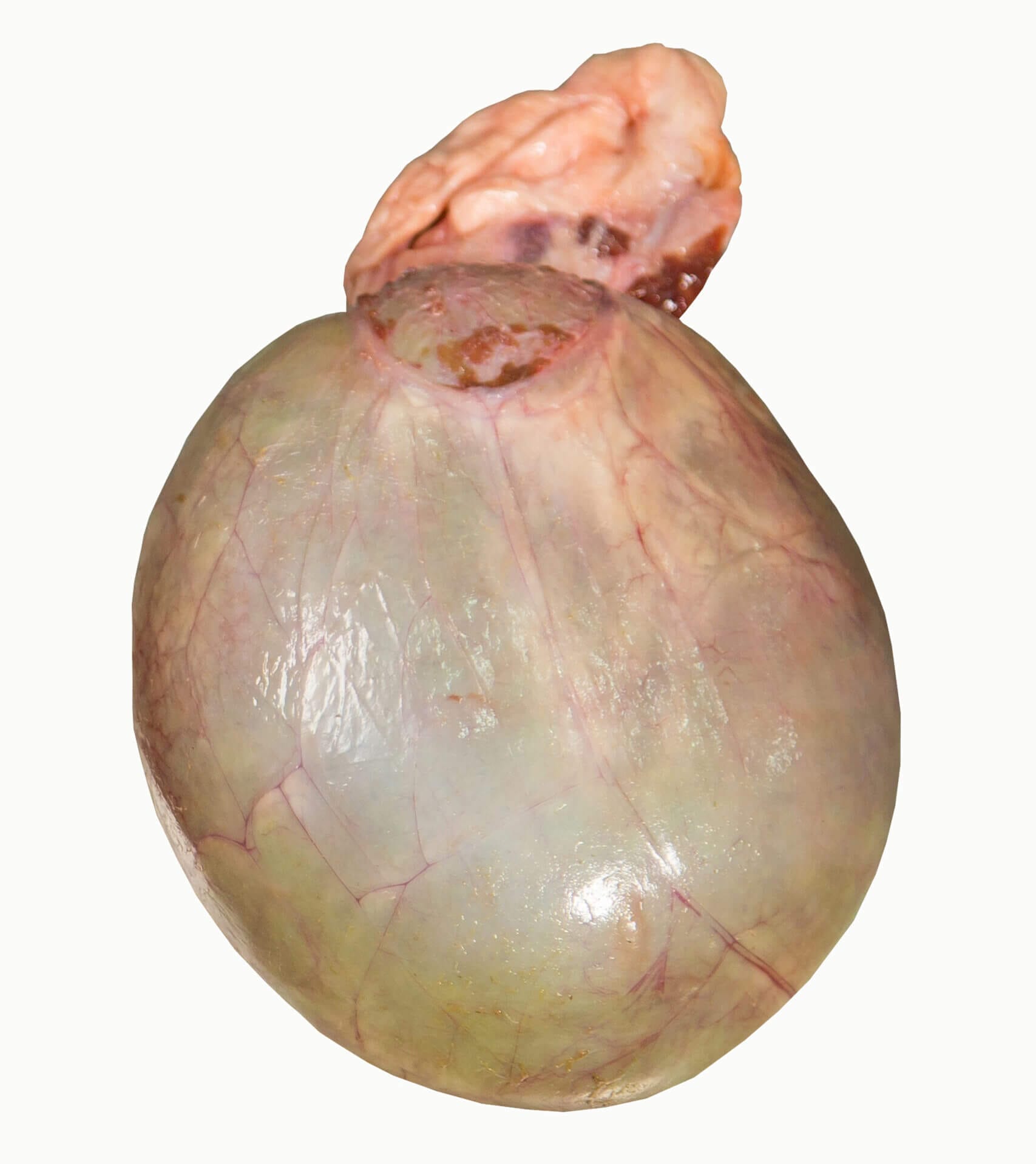 A picture of beef gallbladder.