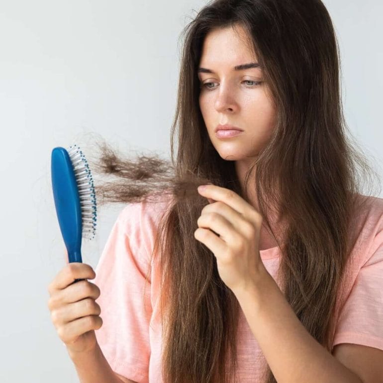Woman with hairloss due to nutrient deficiency (square)