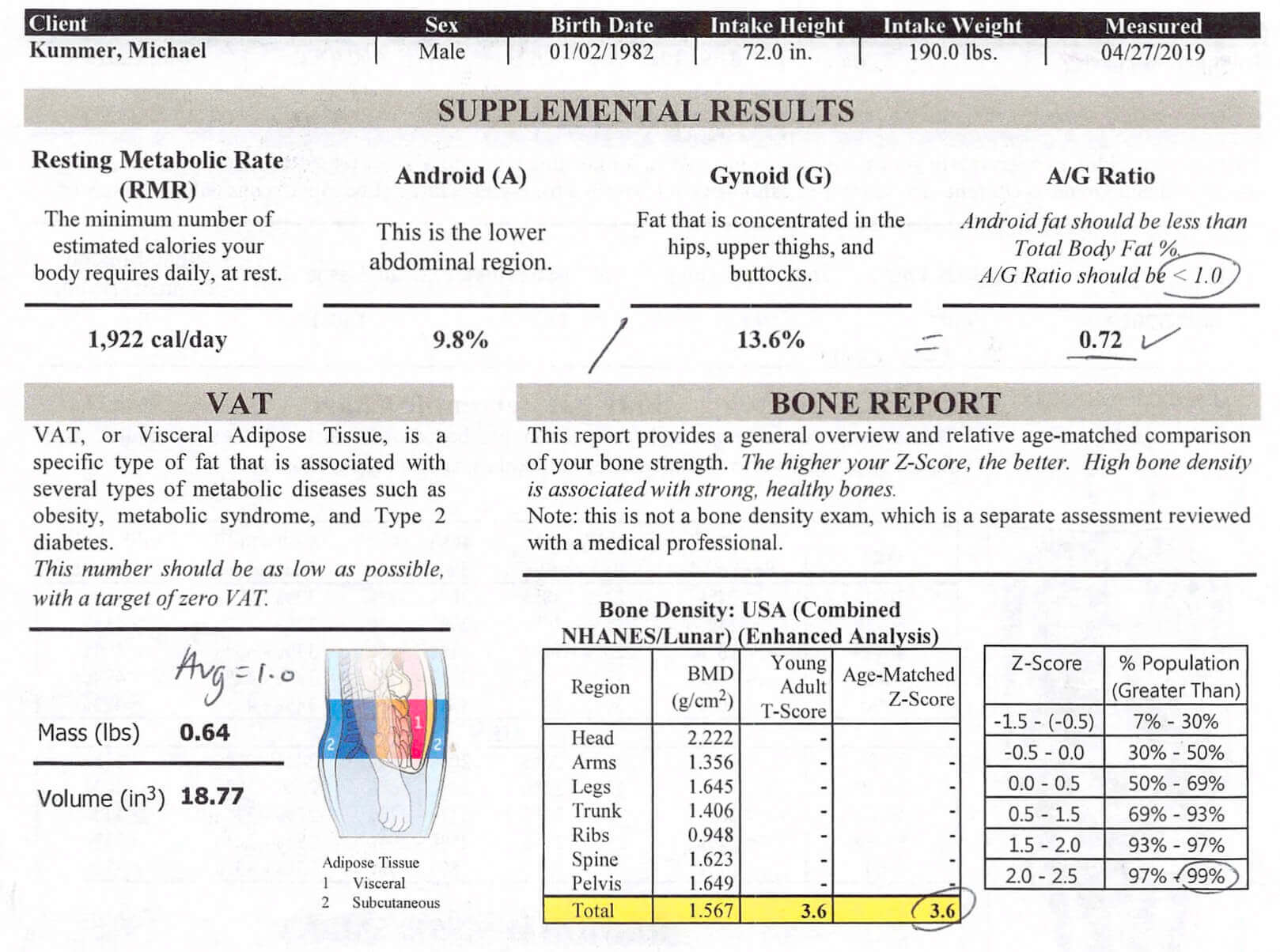 My bone density scan results.