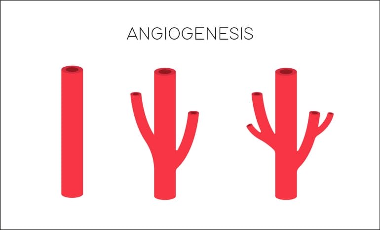 Angiogenesis is the creation of new blood vessels.