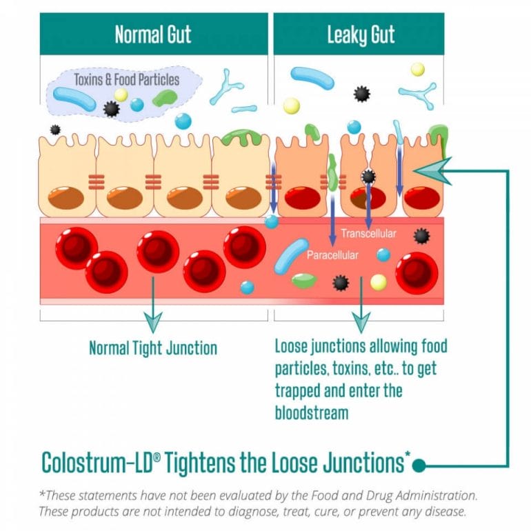 Colostrum-LD can help treat a leaky gut