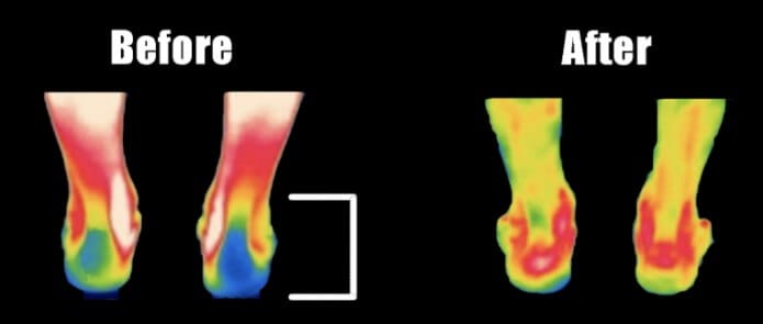 A five-minute session with Move+ Pro improved blood flow to the treated ankle.