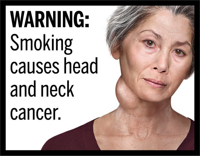Smoking warning label.
