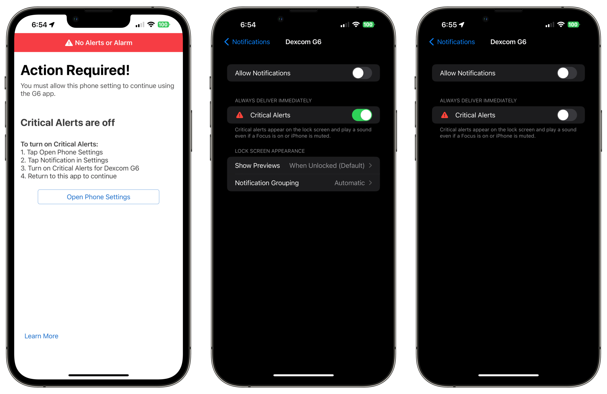 The Dexcom G6 requires Critical Alerts to be enabled.