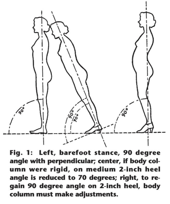 Elevated heels lead to poor posture