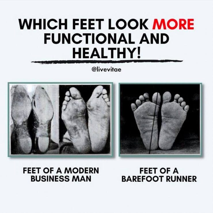 The feet of a modern business man vs. the feet of a barefoot runner.