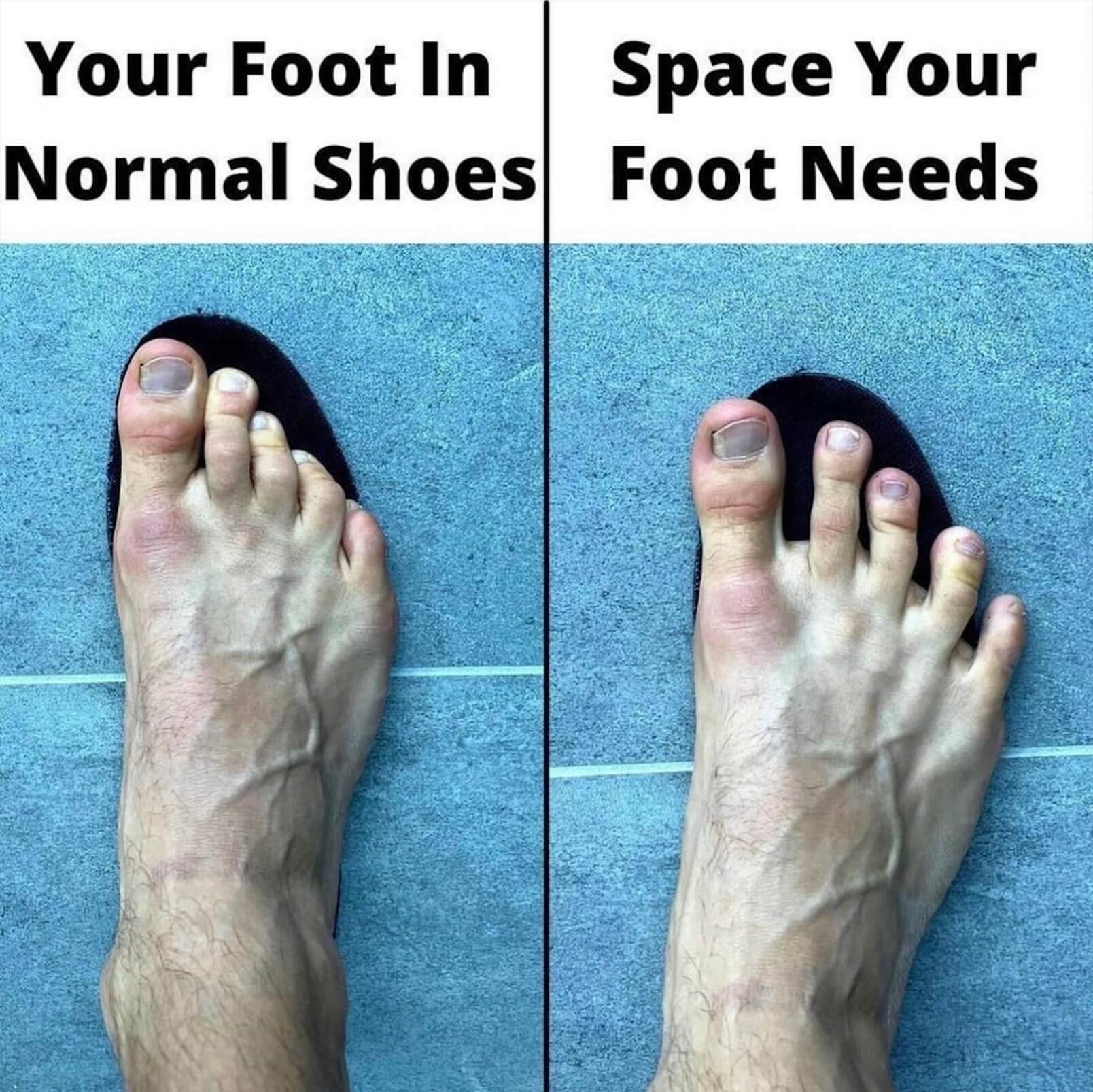 Your foot in normal shoes vs. the space your foot needs.
