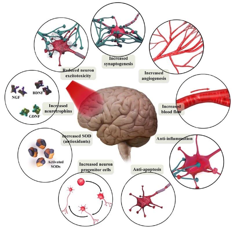 How RLT affects the brain. 