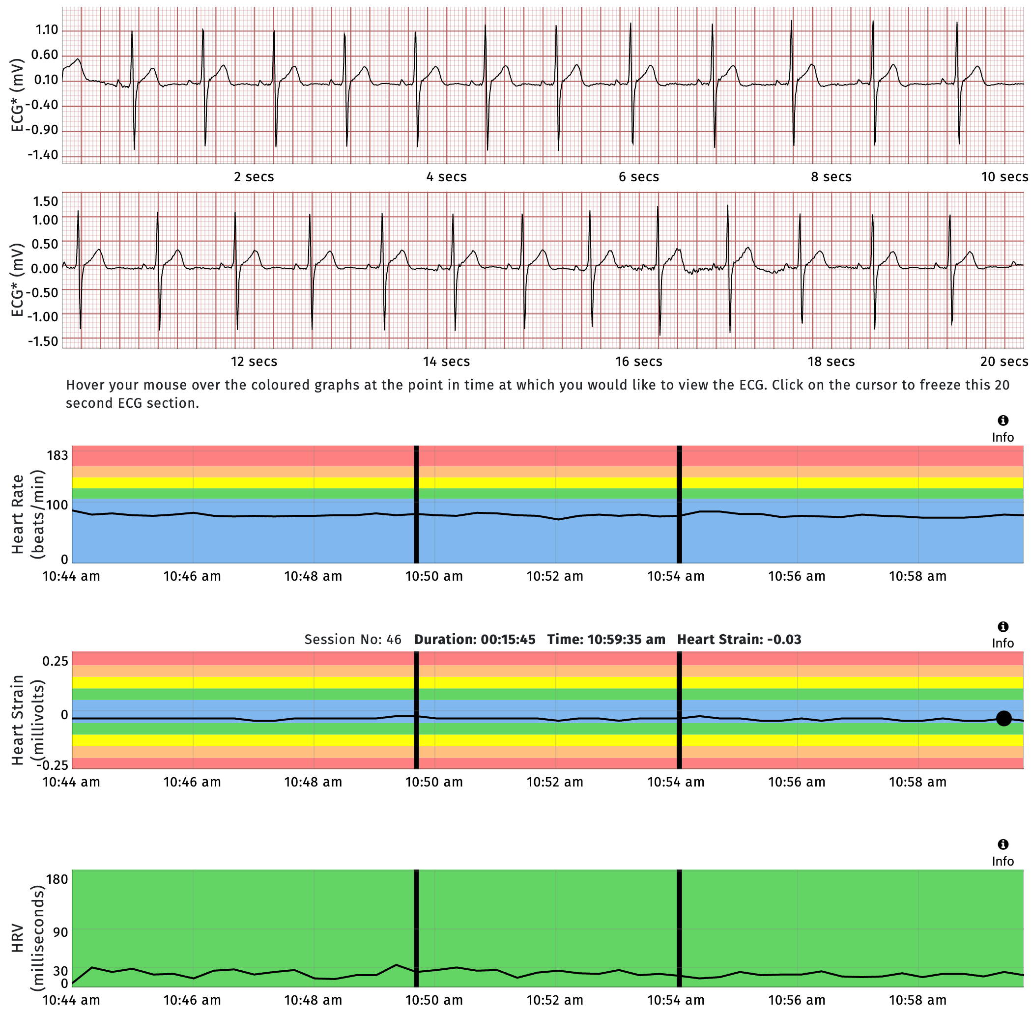 The black bold lines indicate the start and end of the Pulsetto session. There were no changes to any of my biomarkers while using Pulsetto