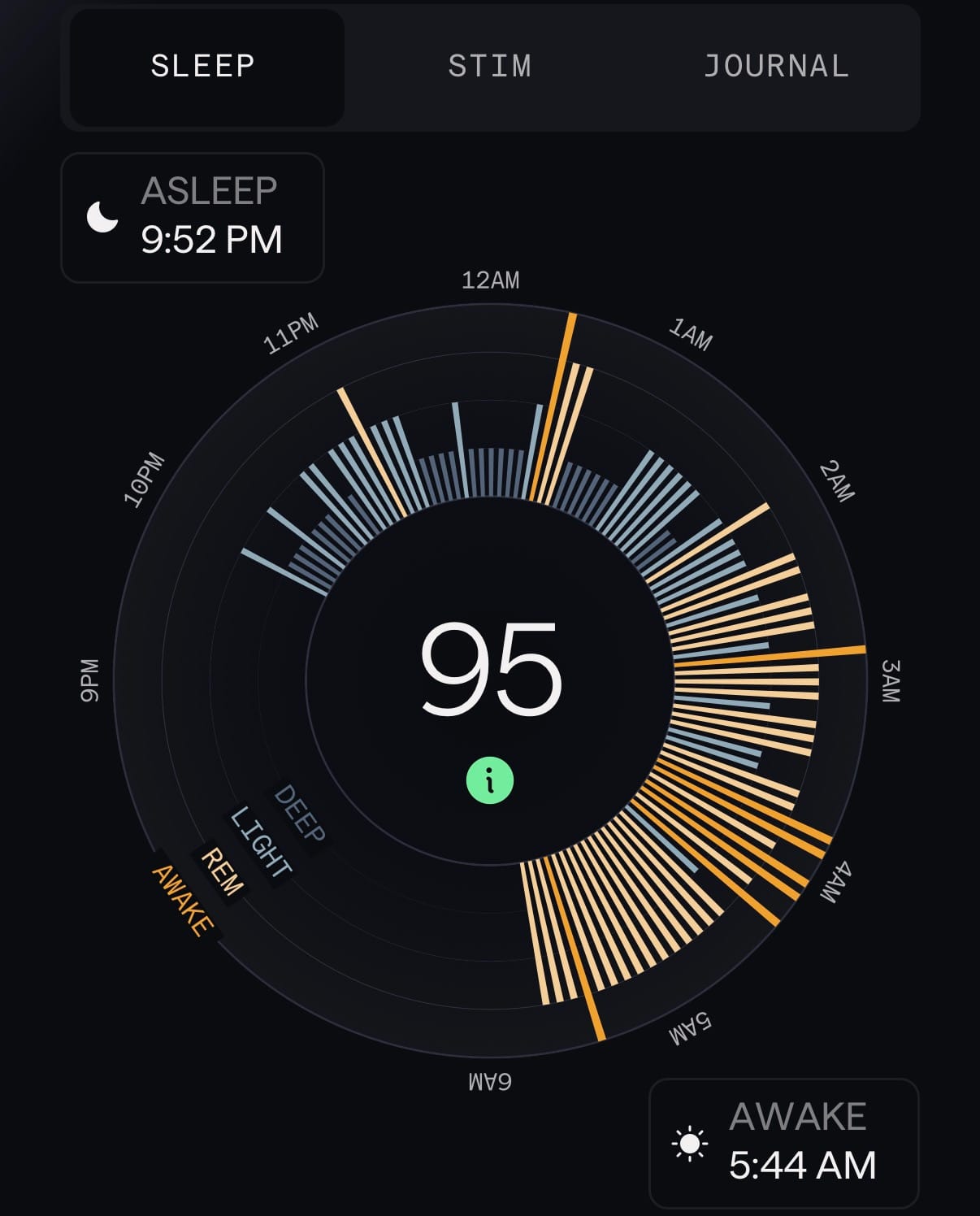 Somnee 2.0 Sleep Report